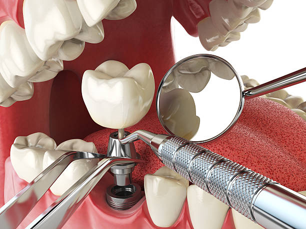Best Weekend Emergency Dentist in Lombard, IL